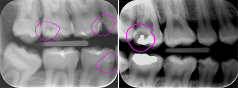 dental assisstant duties using panorama x ray