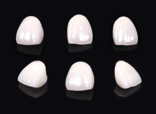 Ceramic,Dentures,And,Crowns,On,Black,Background.,Top,View,On