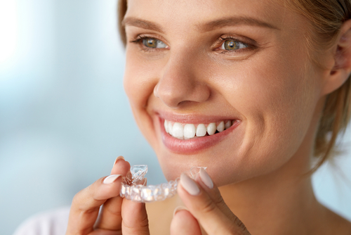 White,Smile.,Portrait,Of,Beautiful,Smiling,Woman,With,Healthy,Straight